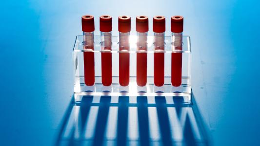 Blood Test for Cancer