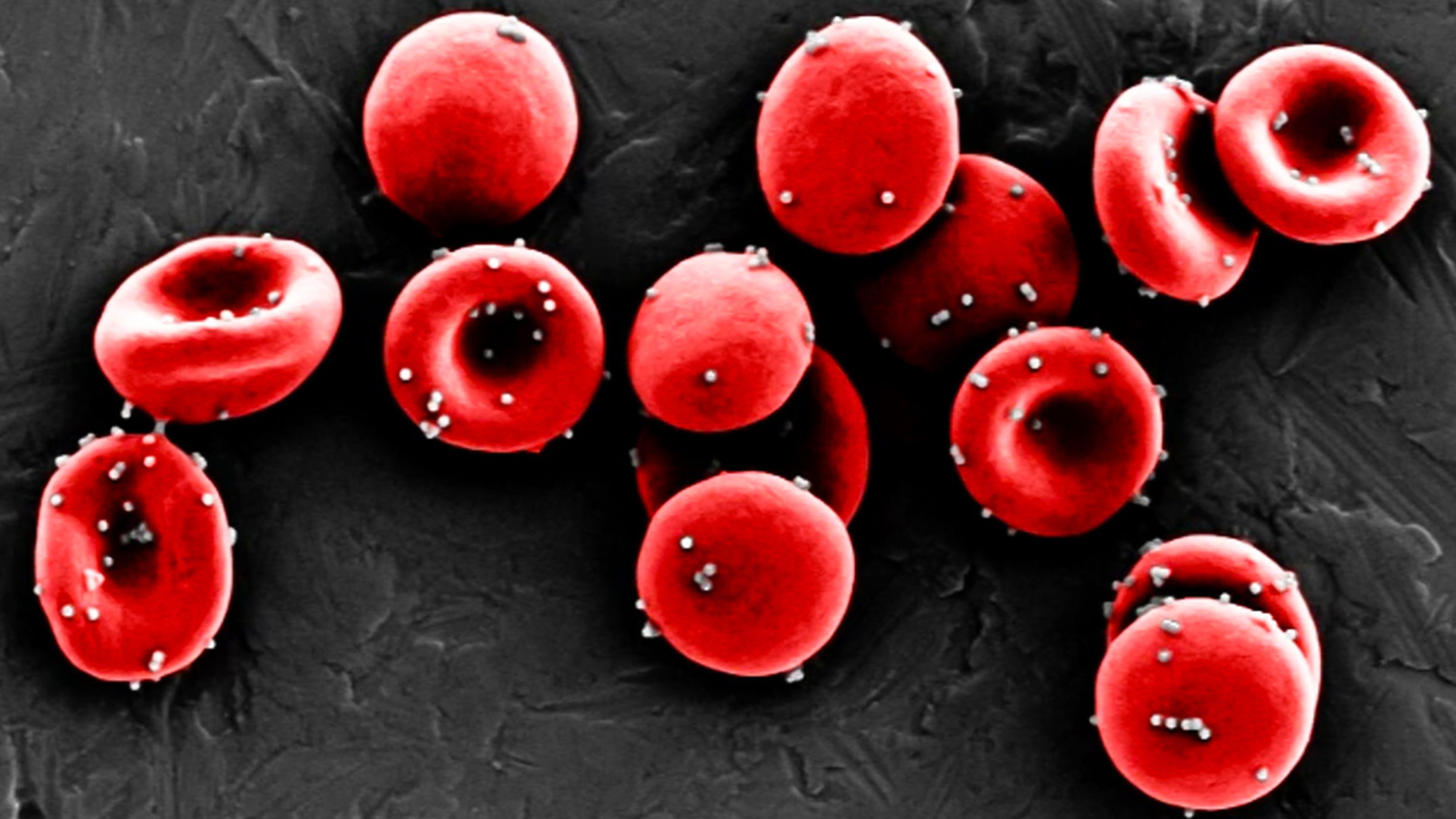 cancer immunotherapy