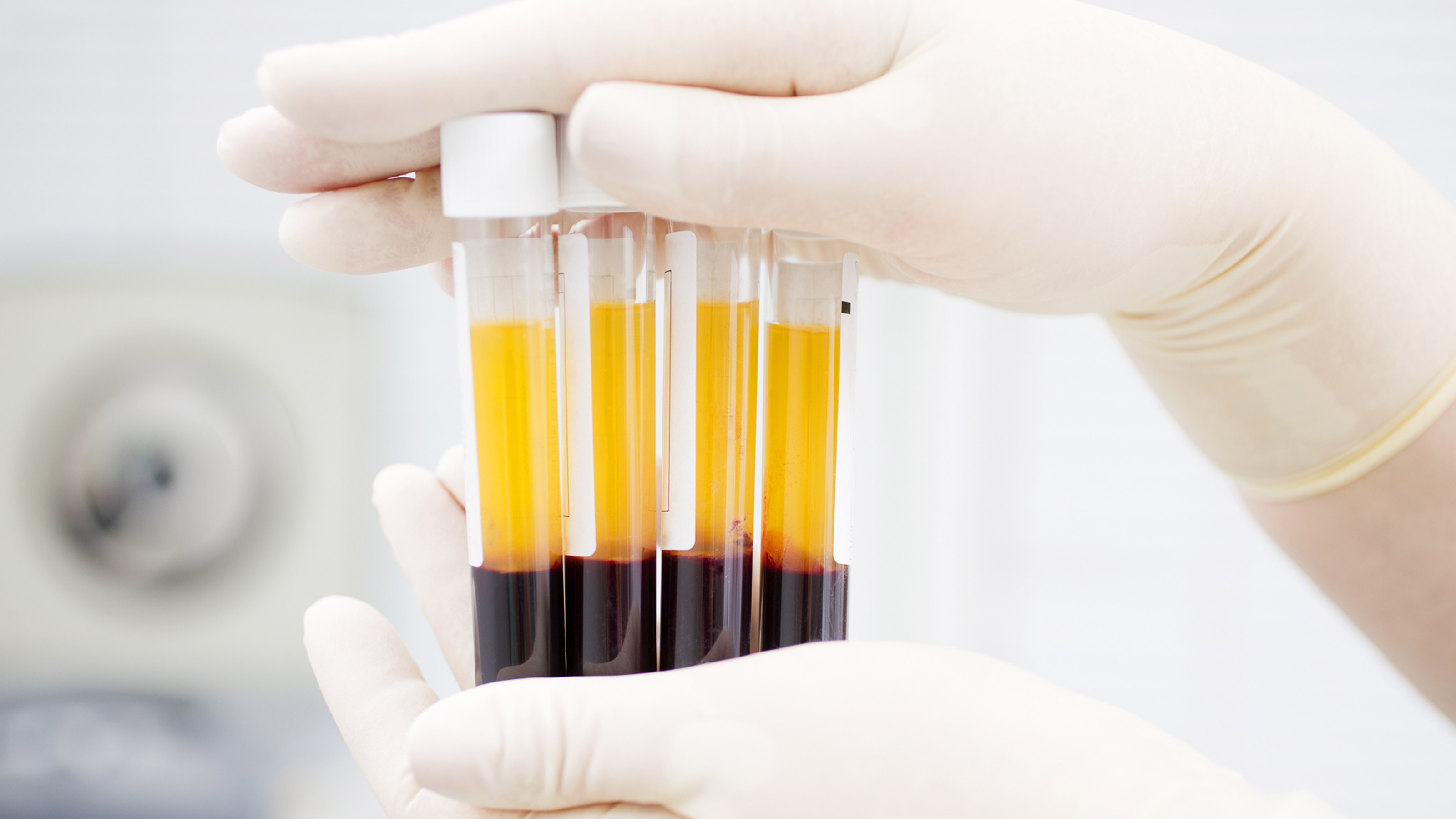 coronavirus survivors