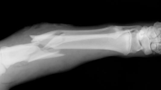 electrical stimulation