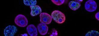 cancer cells hibernate