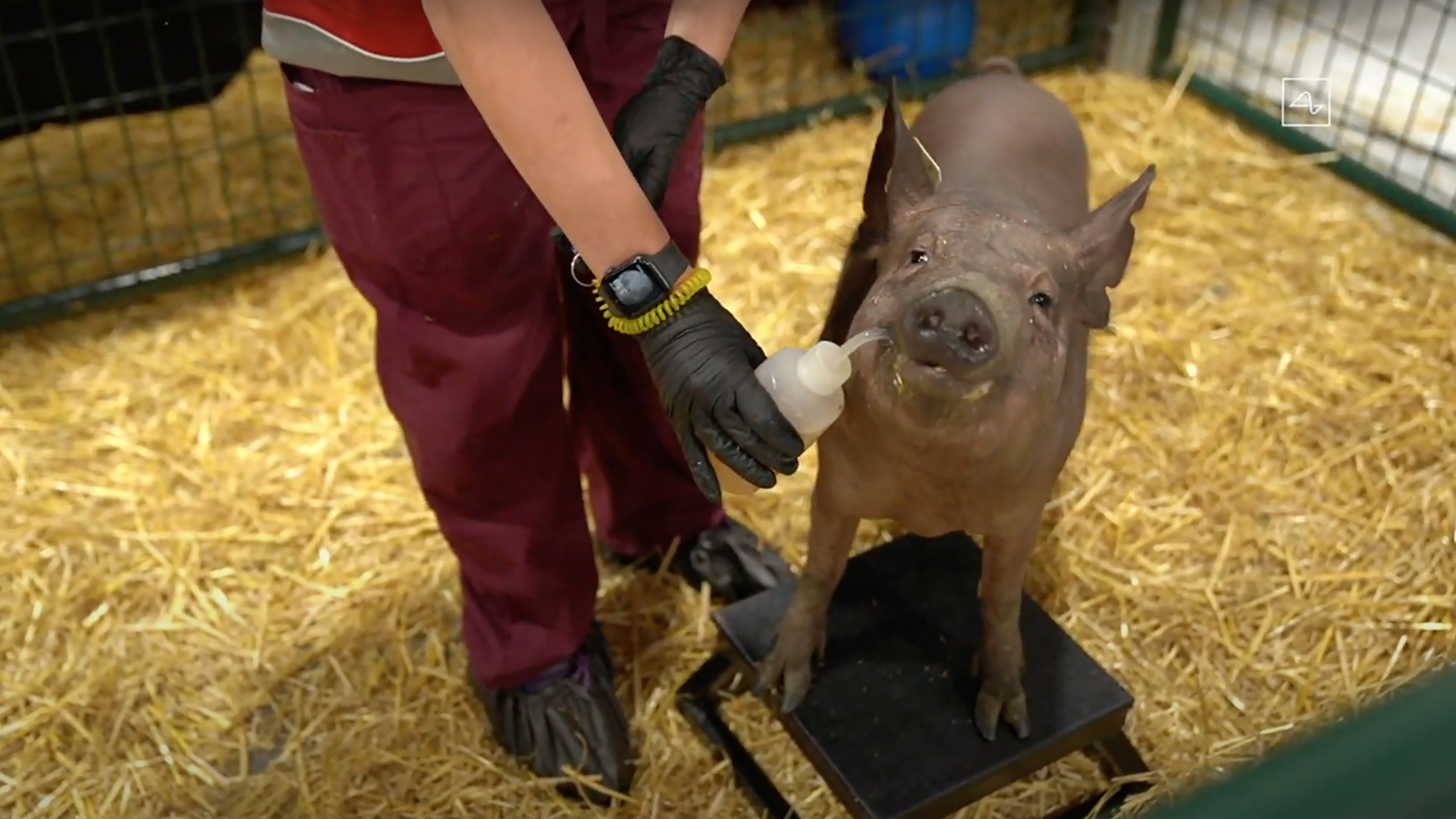 Neuralink Brain Implant