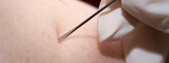 scarification vaccination