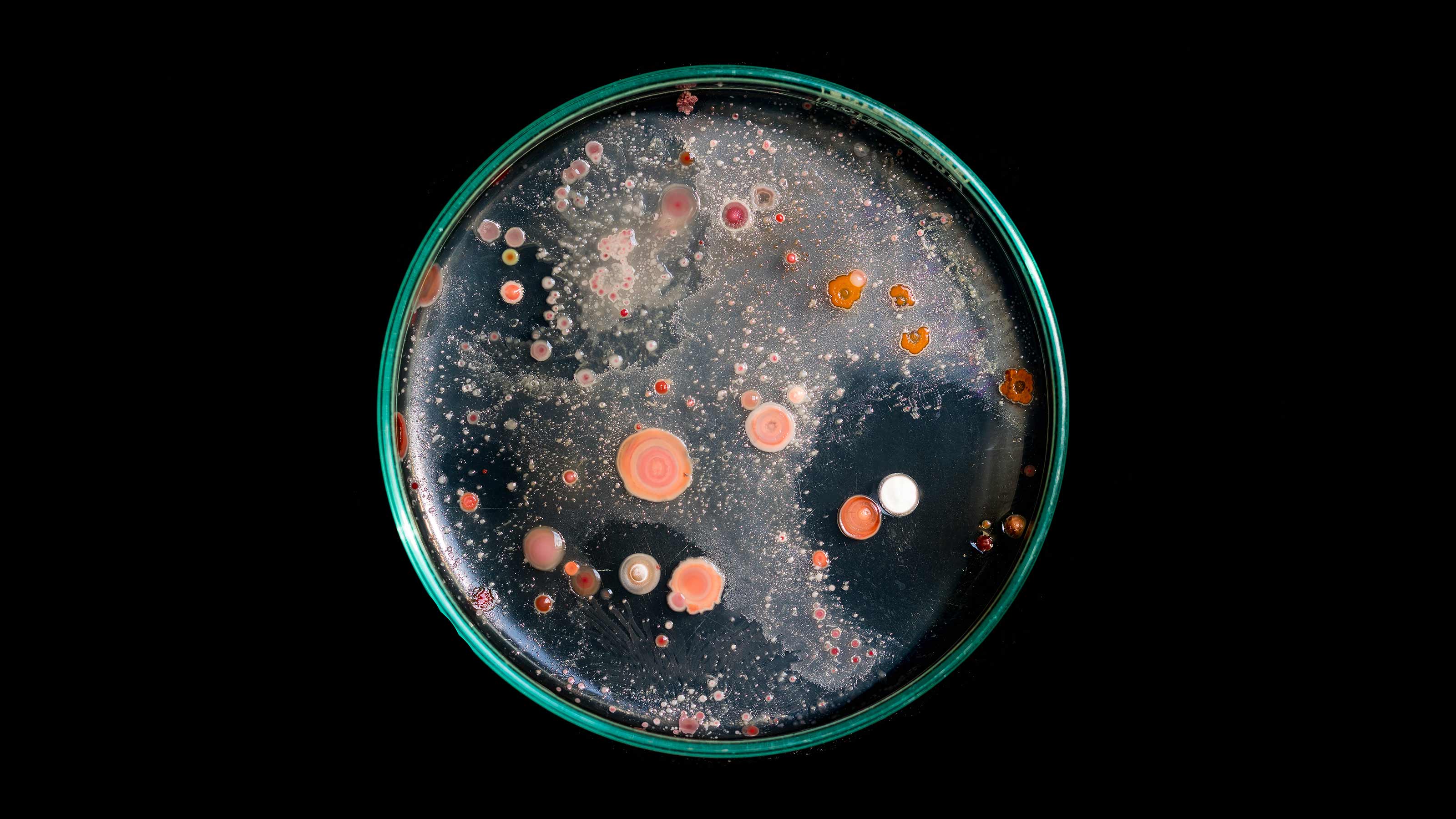 human challenge trial