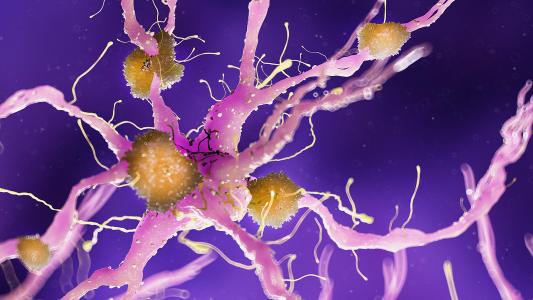 amyloid