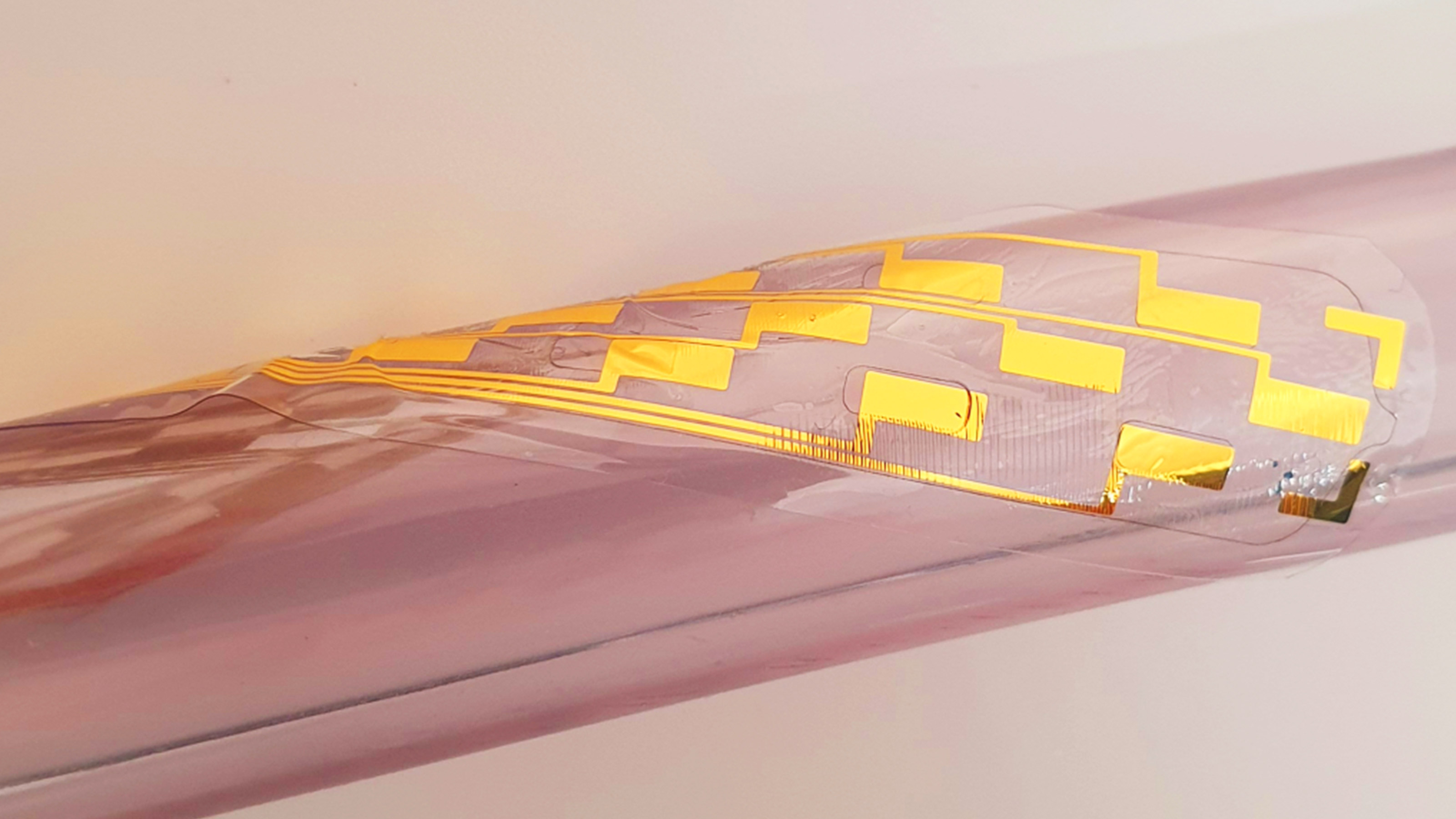 spinal cord stimulation