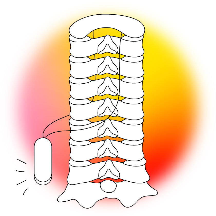 chronic pain relief