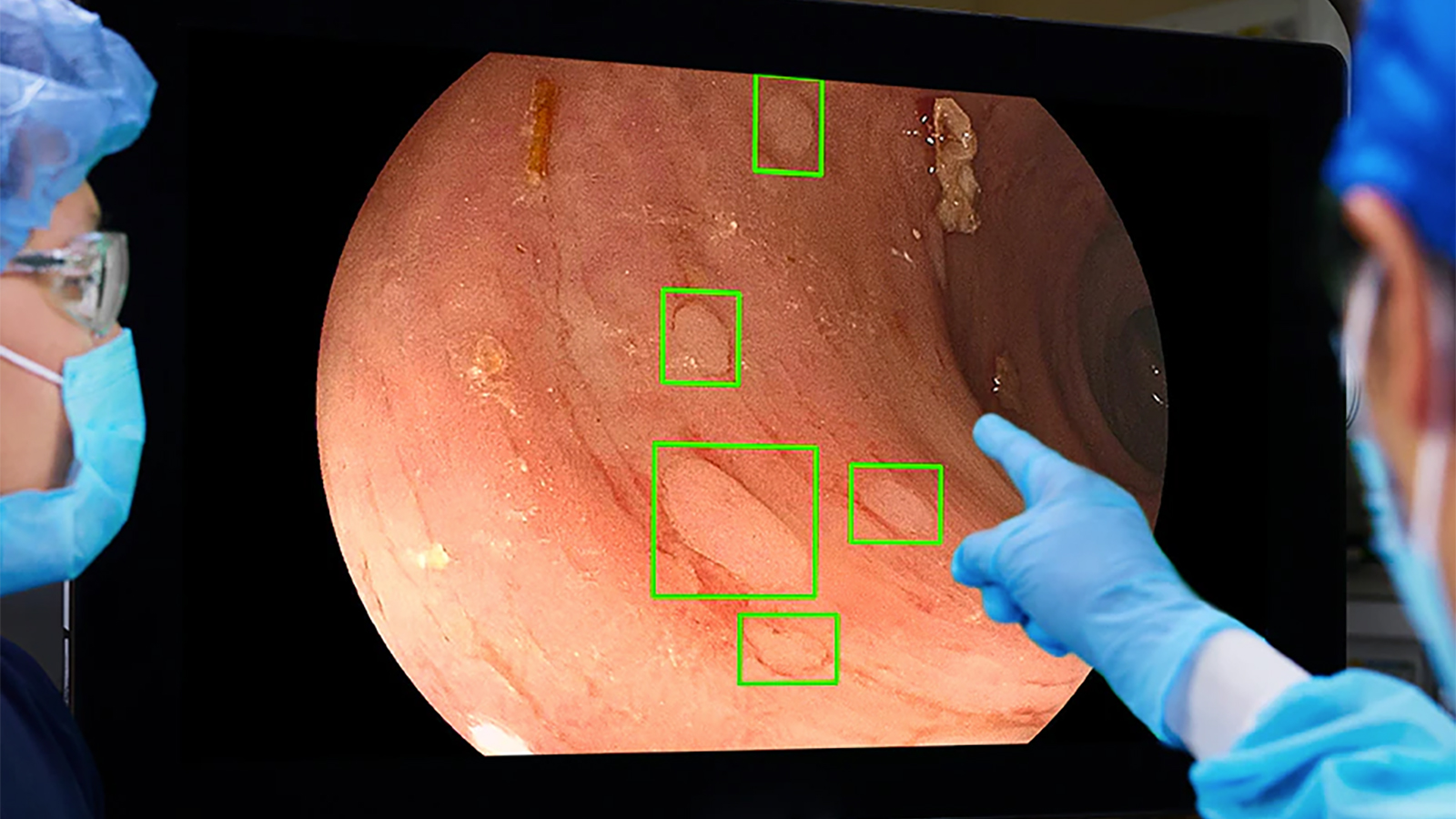 AI disease screening