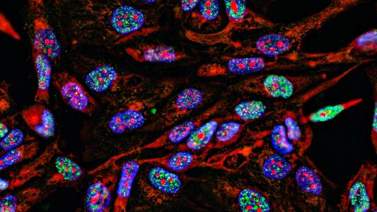 brightly colored cancer cells