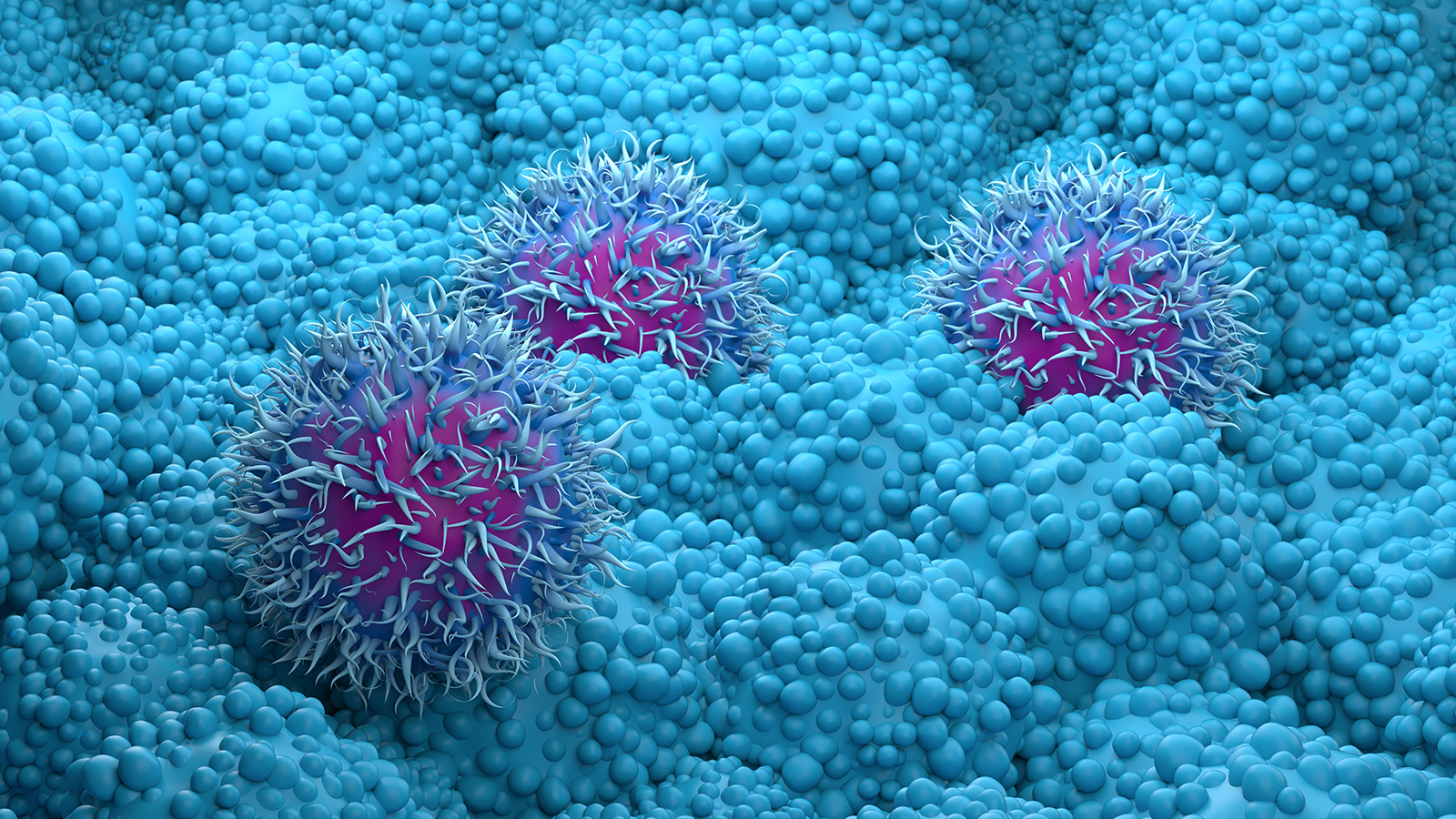 a rendering of pancreatic cancer cells